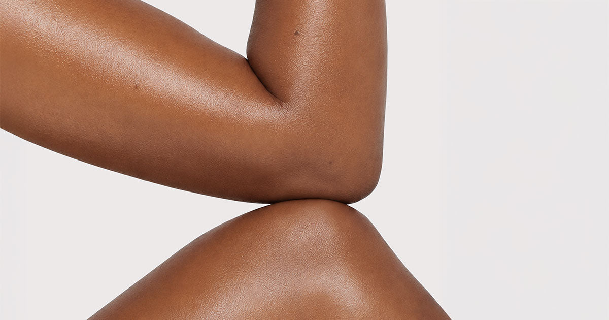 Pourquoi ai-je de la cellulite sur le corps ?
