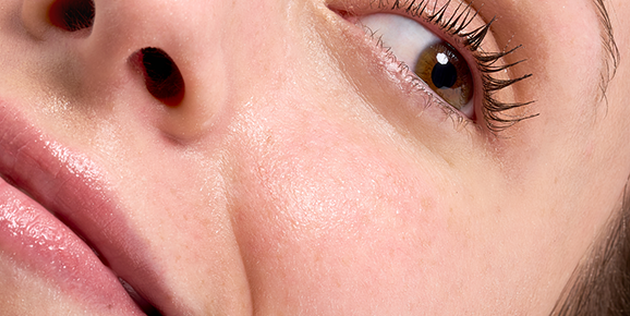 Les peaux mixtes &agrave; grasses sont souvent plus nombreuses &agrave; chercher comment resserrer les pores de leur peau.