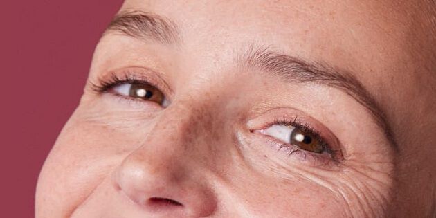 Rides et ridules au coin des yeux : premiers signes de l’âge ou peau déshydratée ?